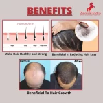 Zenius Hair Oil Is Beneficial For Hair Growth, Hair Fall & Reduces Dandruff 200ml on itshemp.in